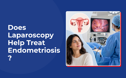 Does Laparoscopy Help Treat Endometriosis?